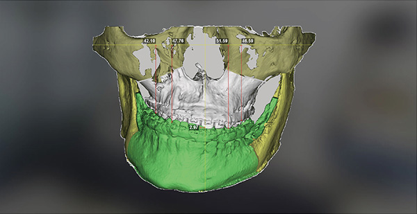 첨단 장비와 정밀 진단