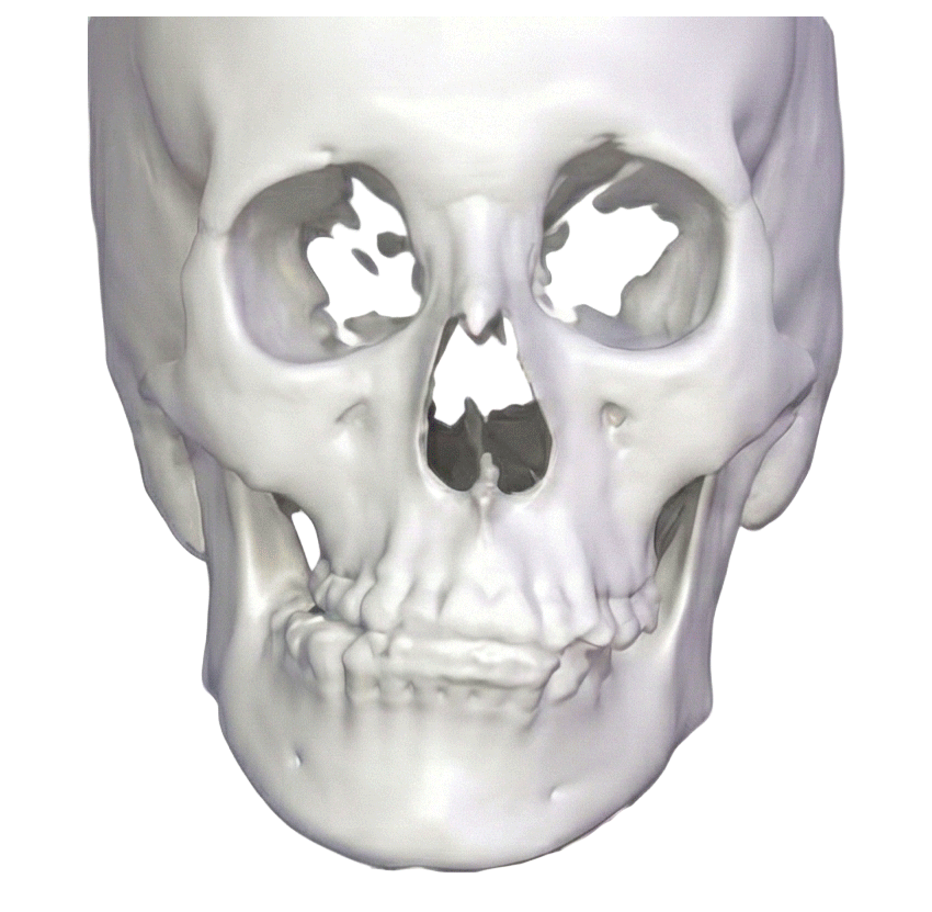 3D 수술 애니메이션 이미지