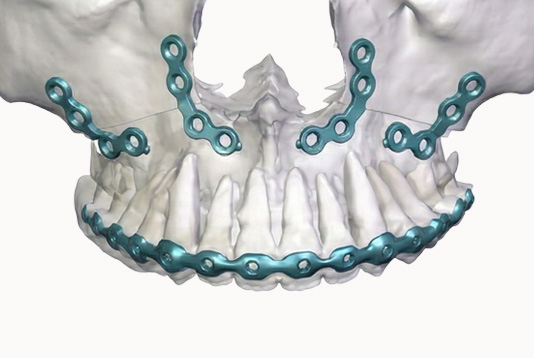 3D 수술 이미지 3