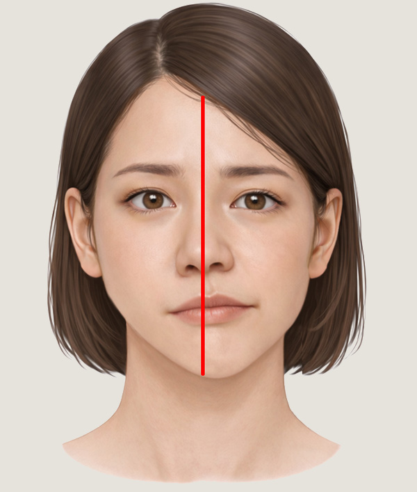안면비대칭 모델 이미지