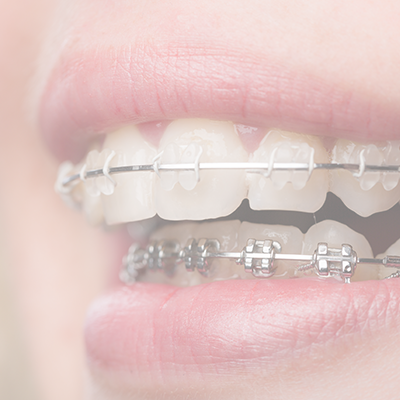 교정 정보 이미지