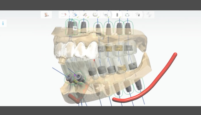 가상 모의 수술