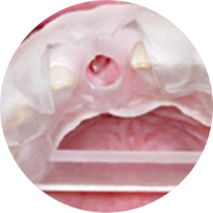 맞춤형 수술유도장치 제작