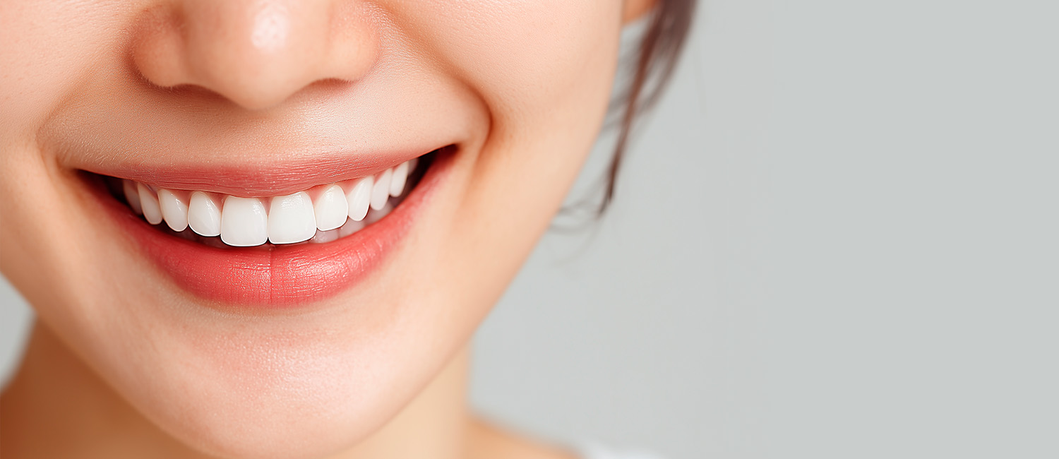 더바른윤곽 치아미백